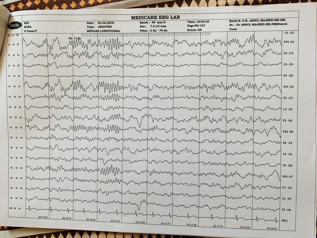 Patient Story